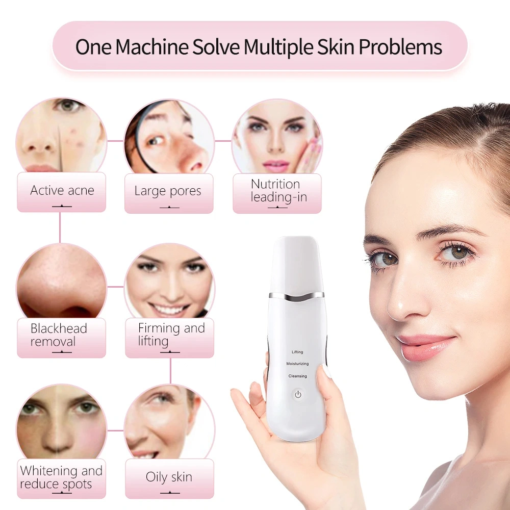 3-in-1 Ultrasonic Facial Spatula for Deep Cleansing, Electric Ultrasonic Skin Scrubber view 4