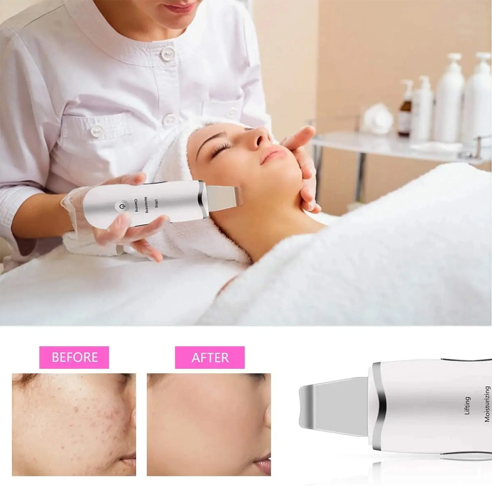 3-in-1 Ultrasonic Facial Spatula for Deep Cleansing, Electric Ultrasonic Skin Scrubber view 5